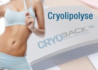 cryolipolyse-cryoback