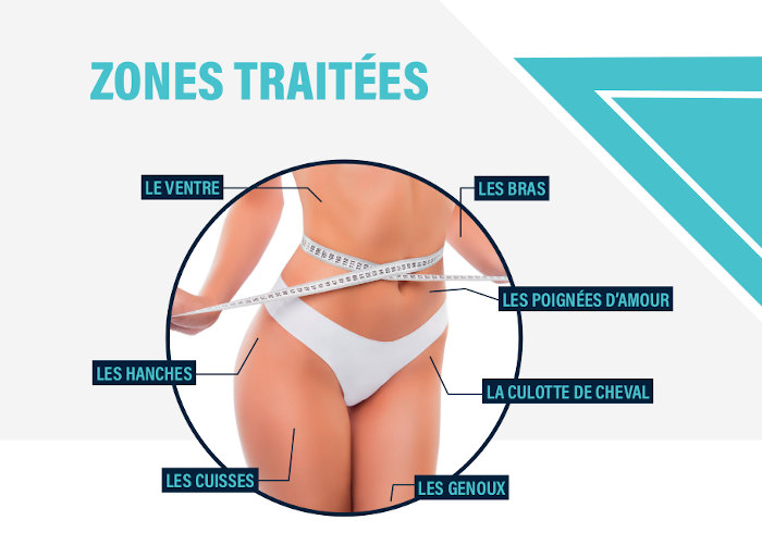 lipolaser-pressotherapie-fitness-zones-traitees-06